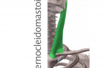 Músculo Esternocleidomastoideo