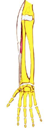 Vista 1 Extensor radial corto