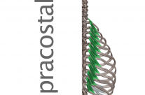 Músculos Supracostales