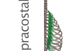 Músculos Supracostales